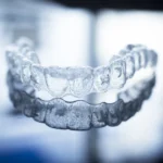 Invisalign Lublin