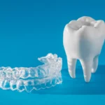 Invisalign Warszawa cena