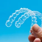 Nakładki Invisalign Szczecin