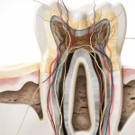Jak wygląda leczenie kanałowe zęba?